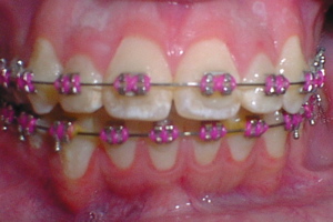 Ortho3